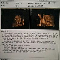 大家知道男女吗？猜猜，本人已经知道