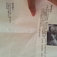 我孕5周，最近小腹连着下体拉扯着疼的很，隔几天就疼一次，每次持续20分钟！今天去做B超说有12mm的盆腔...