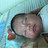 大家帮忙看看宝宝脸上起的是什么，怎么能去掉。