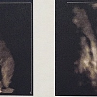 当妈妈的感觉好奇妙，艰辛又幸福。看着小宝宝满是心疼，我想这辈子用全力保护他。