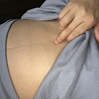 有宝妈胸口心窝处胃里面有硬块的吗  无意间手摸到的