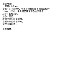 感谢天，感谢地，感谢各位的正能量！！医生都觉得很意外……