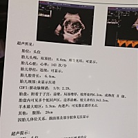 小伙伴们，请帮忙看下男宝还是女宝呗！