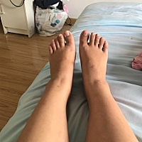 宝妈们，帮忙看下脚踝部分和腿肿不肿？