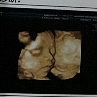 无聊时候就爱看看宝贝的四维照😂😂