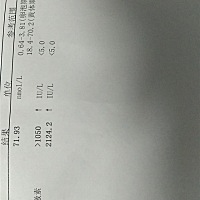 拿到结果前，心里砰砰跳。。。