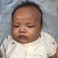 宝宝两个多月，脸上长白斑怎么回事啊