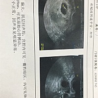 6周+5天，有胎心，宝宝8mm会不会太小了
