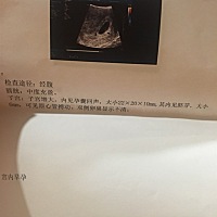 有没有会看男女的？？帮忙看看！