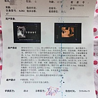 看下是男孩女孩？各位宝妈们。