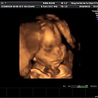 麻烦大家看下像男宝还是女宝嘻嘻嘻