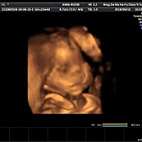 嘻嘻嘻大家看下像男宝还是女宝