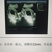 有谁会看嘛，好奇男宝还是女宝呀