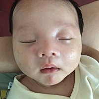 宝宝一个多月，脸上长痤疮，怎么办？