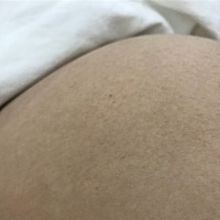 肚子上很多这样的红疙瘩红点点特别痒，什么情况？求告知如何解决？有没有一样的孕妈，聊聊