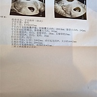 昨天医生说可能宫角孕 吓死宝宝了  这是今天重新做的阴式彩超  有没有帮我分析下的