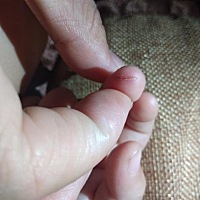 请大家看下这个照片是我昨天晚上9点多拍的，像不像下午2点左右的伤口！是不是当天的伤口，还是之前的，...