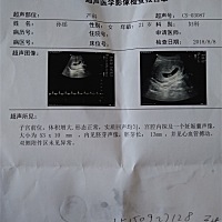 8周，今天刚做的b超。听到胎心激动呀！！！