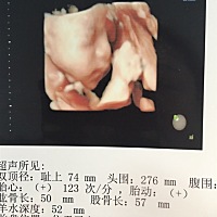 前两天做了思维第一次看到宝宝的样子激动的好想哭，和老公长得好像