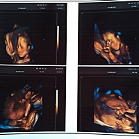 帮忙看看健康吗？男宝还是女宝❤️