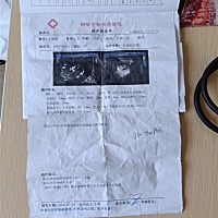 有宝妈会看男女吗？帮我看看是男宝女宝，不管男女我都喜欢只是好奇想知道