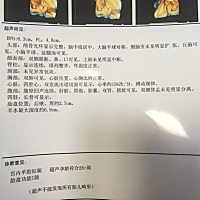 懂得朋友帮忙看看是个小哥哥还是个小妹妹呢？