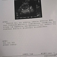 孕29周 2天.今天做B超了。帮忙看看胎儿有多大。