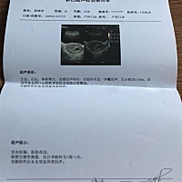 希望各位孕妈帮我看下！