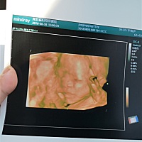 帮忙看看宝宝比较像谁，嘿嘿