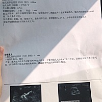 今天查的nt，有能看懂的么