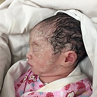 36周就早产啦这会宝宝还在保温箱好担心哦 才2280g