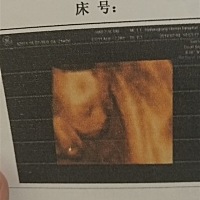 有会看男宝女宝的嘛 头胎好奇