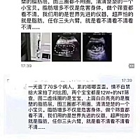 【别超重去怀孕[心碎]】一个医生朋友发圈说；孕妇腹壁脂肪太厚，会导致超声衰减，图像质量差，增加胎儿...