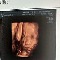 亲爱的宝妈们，帮忙看看男孩女孩，很好奇