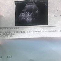 这是nt单子吗？？