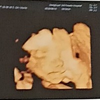 今天去照了四维，感觉宝宝跟我长得一样，有人会看男女吗？