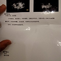 40多天了  各位宝妈能否给透漏一下多长时间再去查查啊   这是我媳妇前两天查的