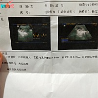 第一个是儿子顺产3岁了，自己心心念念想着闺女闺女，儿子也是每天妹妹妹妹的叫 各种的对着我肚子亲，之...