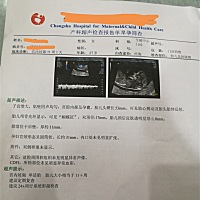 同行的帮我看一下，是是否正常