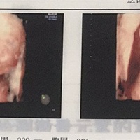 昨天拍的四维，感觉像是儿子。我喜欢女儿。媳妇喜欢儿子。怎么办😱