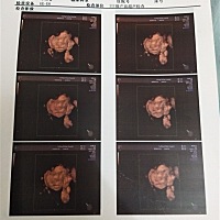 有没有看得懂男宝女宝的，第一胎纯属好奇，我们这里4维有分569多也有769，不知道你们那里有没有分，据说...