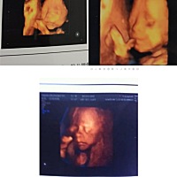 上面两张是二宝，下面是大宝5年前的四维照片，像姐俩吗？