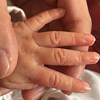 各位宝妈们，你们知道宝宝手上的粒粒是什么东西吗？已经好几天了，手上脚上都是，急死人了