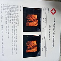 大家帮忙看看是男孩还是女孩