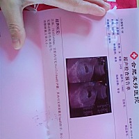 二胎，怀孕50天做的b超，现在九周＋6 天了，嘴巴吃啥都没味，但总是饿，鸡鱼肉荤菜都不想吃，好烦哦！