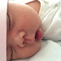 宝宝人中那里生下来就有一点红的，是什么哟！