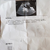 今天怀孕56天，去医院做B超，显示有积液，医生给开了维C维E和口服液，我偶尔也会肚子疼，有褐色分泌物。...