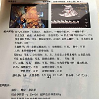 今天早晨陪老婆去做的四维，帮看看像男还是像女，越大越好奇，谢谢大家了