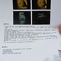 照了四维安全过关。请教一下，看得出是男孩还是女孩吗？