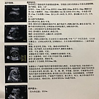 四维顺利通过，姐妹们有没有会看男女宝宝的，哈哈哈